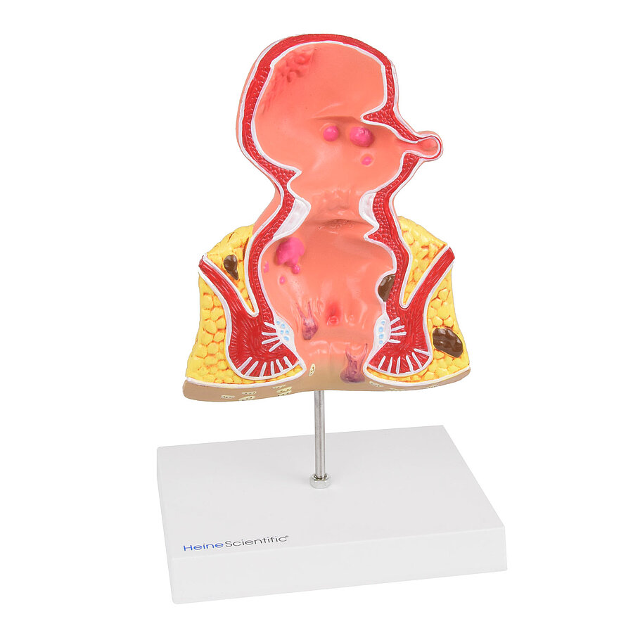 Rectummodel - Zorgdidact - Webshop Anatomische Modellen